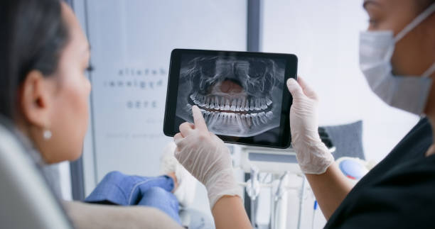 Licensed Dental Implants service in Largo, MD - Smile Center Dentistry